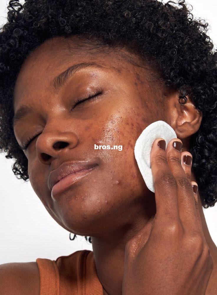 6 Ways to Lower Cortisol Levels on The Face