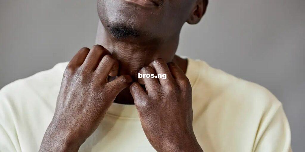 Eczema vs Psoriasis: How to Tell The Difference